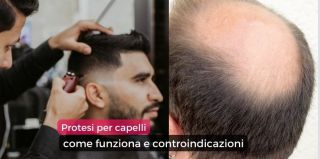 cliniche trapianto di capelli napoli Tricomedica - Abbagnato Tricopigmentazione Napoli