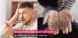 cliniche di rimozione del tatuaggio napoli Tricomedica - Abbagnato Tricopigmentazione Napoli